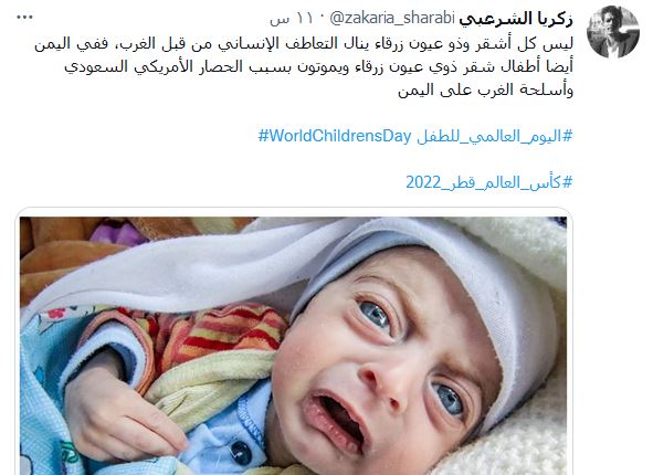 تفاعل واسع مع حملة التذكير بأطفال اليمن 